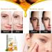 Turmeric Serum Dark Spots 30 ml Spot Corrector Face & Body Anti Aging and Wrinkle Face Serum Reduces Hyperpigtation Age Spots Sun Spot Improve Skin Tone Moisturize Brighten All Types - Buy Online on SooperMarket.com