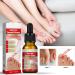 Ingrown Toenail Treatment Nail Growth Ingrowing Toenail Treatment Nail Helper Fungal Nail Treatment Correction Oil Drops Ingrown Toenail Corrector Toe Nail Fungus Treatment Cuticle Oil - Buy Online on SooperMarket.com