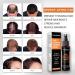 Trendyfave Hair Regrowth Spray Hair Growth Serum Thickening Hair Volume Spray Anti Hair Loss Spray Hair Rapid Growth Spray Natural Ingredients Hair Regrowth Serum Repair Hair Follicles -30ML - Buy Online on SooperMarket.com