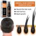 Trendyfave Hair Regrowth Spray Hair Growth Serum Thickening Hair Volume Spray Anti Hair Loss Spray Hair Rapid Growth Spray Natural Ingredients Hair Regrowth Serum Repair Hair Follicles -30ML - Buy Online on SooperMarket.com