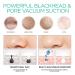 VOYOR Blackhead Remover Pore Vacuum - Electric Face Cleaner with 6 Suction Heads for Acne and Whitehead Removal - Buy Online on SooperMarket.com