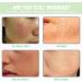 Panthenol Face Serum Niacinamide Serum Brightening Serum Hydrating Serum Korean Serum For Repair Dark Spot Corrector For Face Calming Serum Green Tea+Hyaluronic Acid Panthenol Cream - Buy Online on SooperMarket.com