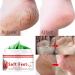 Pomegranate Hand and Foot Cream | Repair Dry Cracked Heels & Chapped Skin | Moisturizing Salve with Pomegranate Extract & Peppermint | International Shipping Available - Buy Online on SooperMarket.com