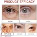 Rose Eye Cream Under Eye Cream for Dark Circles Eye Bags Remover Hydrating Eye Cream Rose Eye Cream Anti Aging Dark Circles Under Eye Treatment For Puffy Eyes Fine Lines Firming & Brightening - Buy Online on SooperMarket.com