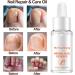 Organic Cuticle Nail Oil 30ml Vitamin B & E Essential Oil Moisturize with Convinient Dropper Design Nail Cuticles Oils Treatment Damaged Dry for Nail Care Repair Growth (Herbal) - Buy Online on SooperMarket.com