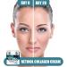 Retinol Collagen Cream for Face with Hyaluronic Acid Anti Aging Moisturiser Cream with Collagen Retinol Face Cream to Reduce Wrinkles & Spots Day & Night Use 50ml - Buy Online on SooperMarket.com