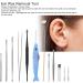 Stainless Steel LED Ear Wax Remover Kit for Adults & Kids | Reusable Ear Cleaners with Soft Tips - Buy Online on SooperMarket.com