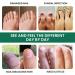 Extra Strength Toenail Fungus Treatment - USA Made Nail Fungus Solution for Thick, Broken & Discolored Nails - Buy Online on SooperMarket.com