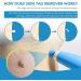 OakRidge Products Skin Tag Remover Painless Pen Removal Kit Tools with 40 Micro and Regular Bands Easy Device to Remove(1mm-8mm) Tags (2in1 Kit) (2-8mm) Blue Number Of Items: 1 1.0 count - Buy Online on SooperMarket.com