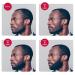Godefroy Thick Beard and Mustache Growth Serum for Ethnic Hair Types 15ml - Promotes Thicker Hair Growth for Ethnic Hair - Buy Online on SooperMarket.com
