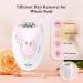 QFS Epilator 2 - Women's Facial & Body Hair Removal Device - Buy Online on SooperMarket.com