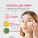 Epielle Collagen Under Eye Mask (60 Sheets) - Dark Circles and Puffiness Reduction for Mother's Day and Teacher Appreciation Gifts - Buy Online on SooperMarket.com