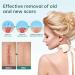 CRusio Awzlove Ampoule Scar Removal Serum - Remove New Scars in 3 Weeks, Old Scars in 6 Weeks (1pcs) - Buy Online on SooperMarket.com