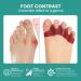 Welnove 8-Pack Toe Separator to Correct Bunions and Restore Toes to Their Original Shape Bunion Corrector for Women Men Toe Spacers for Gifts (Deep Red) - Buy Online on SooperMarket.com