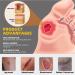 KXC Decubitus Treatment Cream 20g - Relief for Pressure Sores (4 pcs) - Buy Online on SooperMarket.com