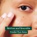 The Body Shop Edelweiss Eye Concentrate 10ml | Vegan Formula | Smoothes Under Eye Area - Buy Online on SooperMarket.com