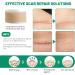 3 Rolls Silicone Scar Sheets(1.6" x 60" Each) Silicone Patches for Scars Reusable Scar Removal Strips for Prevention and Repair - Buy Online on SooperMarket.com