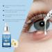 Stye Eye Treatment & Chalazion Remover | Eye Relief Serum & Gentle Lash Cleanser - Fast International Shipping - Buy Online on SooperMarket.com