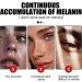 Trendyfave Facial Brightening Serum Face Moisturiser Hydrating Serum Face Serum for Women & Men Face Serum With Hyaluronic acid Squalane Shea Butter and Vitamin E Serum for Face Care - Buy Online on SooperMarket.com