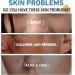 Acne Serum With Plant-Based Formula Dark Spot Correcting Glow Serum Dark Spot Serum Brightening Serum Hydrating Serum Improve Redness And Blemishes Smoothing & Calming Suitable For All Skin Types - Buy Online on SooperMarket.com