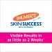 Palmers Skin Success Anti-Dark Spot Fade Cream with Vitamin E and Niacinamide - 4.4oz | Reduce Dark & Age Spots | For All Skin Types - Buy Online on SooperMarket.com