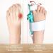 Hallux Valgus Corrector | Ergonomic Adjustable Bunion Support | Professional Orthopedic Care for Home - Buy Online on SooperMarket.com