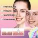 Acne Pimple Patches 96 Dots Colourful Spot Patches Hydrocolloid Patches Acne Patch Star Pimple Patches Cute Blemish Patches Acne Patches Spot Face Body Blemish Cover Skin Care - Buy Online on SooperMarket.com