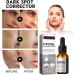 Trendyfave Facial Brightening Serum Face Moisturiser Hydrating Serum Face Serum for Women & Men Face Serum With Hyaluronic acid Squalane Shea Butter and Vitamin E Serum for Face Care - Buy Online on SooperMarket.com