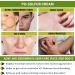 DermoTIS Sulphur 7% Cream for Oily Acne Seborrheic Skin Care Removes Skin Seborrheic Scales Exfoliating Properties Face and Body Unisex - Buy Online on SooperMarket.com