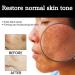 Me-lanin Correcting Cream Skin Whiten Cream Dark Spots Corrector Cream Facial Repair Cream Natural Brightening Moisturizer Cream For Body Face Neck - Buy Online on SooperMarket.com