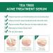 Tea Tree Ance Treatment Serum Tea Tree Oil For Skin Tea Tree Essential Oils Anti-Pimples and Acne Moisturizer and Brighten Skin.Tea Tree Oil for Diffuser Humidifier DIY Home Office 17ml - Buy Online on SooperMarket.com