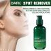 Hyaluronic Acid Facial Serum Hyaluronic Acid Serum Anti Wrinkle Serum Dark Spot Remover for Face Hyaluronic Acid Face Serum for Women Face Moisturiser Skin Tightening Hydrating Plump Skin - Buy Online on SooperMarket.com
