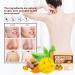 Turmeric Soap Bar for Face & Body - Moisturizing Soap for Hyperpigmentation & Dark Spots - All Skin Types - 1 Count - Buy Online on SooperMarket.com
