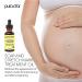 PURA DOR Organic Scar & Stretch Mark Treatment Oil | 1oz For Skin - Rosehip, Wheat Germ, Argan, Tamanu, Carrot, Rosemary, Lavender, Geranium, Patchouli, Sage - Buy Online on SooperMarket.com