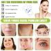 160 Pieces Invisible Face Lift Tape | Enhance Your Look with Clear Effective Skin Lifting Strips - Buy Online on SooperMarket.com