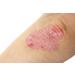 Blueline 10% Urea Cream 500ml | Body Cream for Very Dry Skin Psoriasis & Neurodermatitis | Itch Relief & Skin Care for Rashes & Blemishes - Buy Online on SooperMarket.com