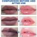 Lip Lightening For Dark Lips Aloe Vera Lip Balm Lips Pink Bleaching Cream Balm Moisturizing Lip Balm Whitening & Brightening Remove Dark Lips 3g - Buy Online on SooperMarket.com