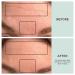 Dermaclara Silicone Face Patches for Wrinkles & Fine Lines | Anti-Wrinkle Treatment - Pregnancy Safe Skincare | Reusable Under Eye, Forehead & Face Wrinkle Patches - Buy Online on SooperMarket.com