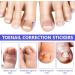Toen il Correction Sticker 100Pcs: N il Repair P tches Restores Appearance of Discolored or Damaged Nails Foot Care - Buy Online on SooperMarket.com
