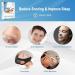 MIEUTE Sleep Mouth Tape - 120Pcs for Better Nose Breathing and Snoring Relief - Buy Online on SooperMarket.com