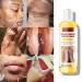 Extra Strong Peeling Oil - Chemical Exfoliant for Face & Body | Reduces Wrinkles Stretch Marks & Dead Skin - Buy Online on SooperMarket.com