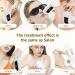 Rodzon IPL Laser Hair Removal Device - Painless Hair Remover for Women | Facial Armpits Legs Arms Bikini Line (Purple & White - Buy Online on SooperMarket.com