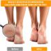12 PCS Stainless Steel Foot Grater Set - Professional Callus Remover for Feet - Buy Online on SooperMarket.com