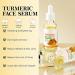 Turmeric Serum Dark Spots 30 ml Spot Corrector Face & Body Anti Aging and Wrinkle Face Serum Reduces Hyperpigtation Age Spots Sun Spot Improve Skin Tone Moisturize Brighten All Types - Buy Online on SooperMarket.com