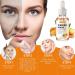Turmeric Serum for Dark Spots Removal Turmeric Dark Spot Corrector Serum for Face & Body Turmeric Oil Age Spot Corrector Skin Care Moisturizing Serum - Buy Online on SooperMarket.com