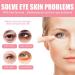 Hyaluronic Eye Cream Stick Caffeine Relax Eyes Fatigue Eye Cream Anti Aging Reduce Under The Eyes Puffiness Rosehip Firming Eye Serum Eye Lift For Women And Men - Buy Online on SooperMarket.com