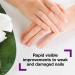 Emtrix Nail Renewal with Tea Tree Oil | Nail Strengthener for Damaged Nails | Healthy Nail Growth | Vegan | 10ml - Buy Online on SooperMarket.com