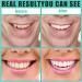 SJENG Smile Bright - 4 Pairs of dentures and 4 Pieces of Tweezers Best Dentures and False Teeth Set with Bonus Tweezers - Enhance Your Smile Today - Buy Online on SooperMarket.com