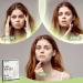 AUSLKA XL Blemish Acne Pimple Patches (44 Strips) - Hydrocolloid Spot Dots for Large Blemishes - Pimple Stickers for Larger Areas - Buy Online on SooperMarket.com