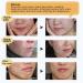 3 Pack TCM Scar Removal Cream - Scar Reducing Treatment for Stretch Marks, Acne Scars, Surgical Scars - 1.1 Ounce (Pack of 3) - Buy Online on SooperMarket.com
